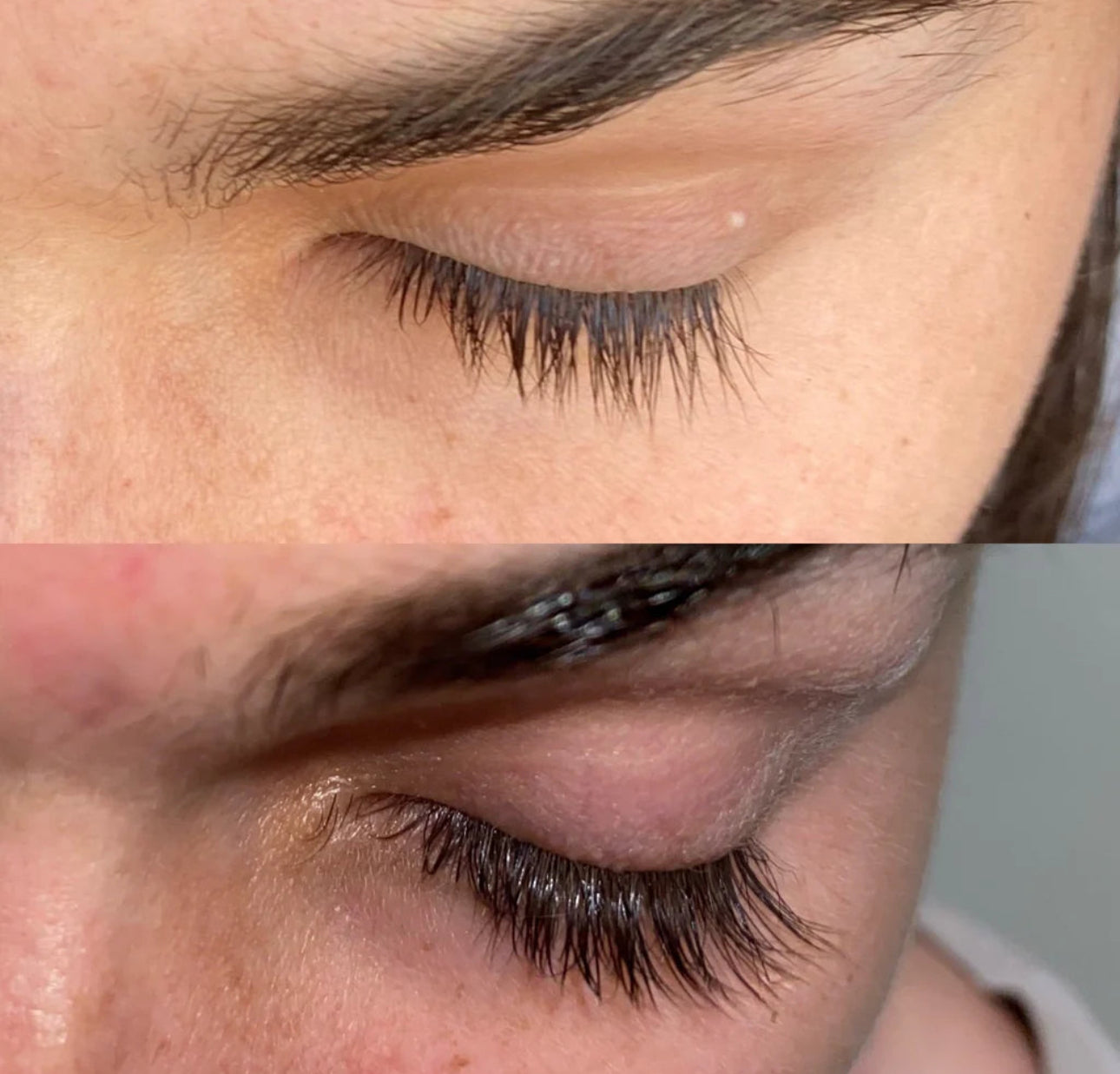 Eyelash growing Serum